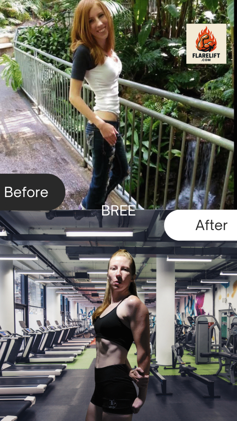 BEFORE AND AFTER FLARELIFT